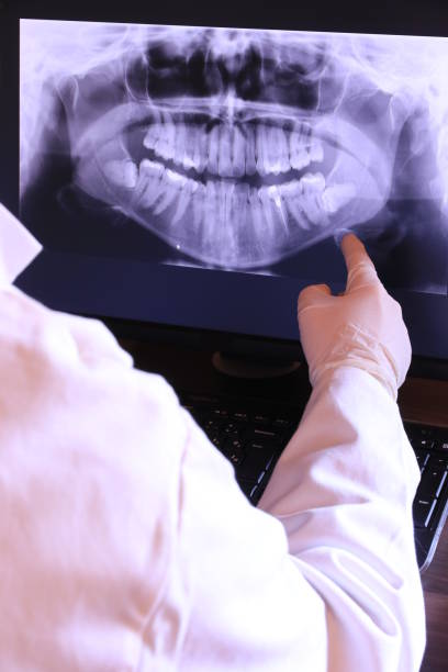 Best Emergency Wisdom Teeth Removal in Sangaree, SC