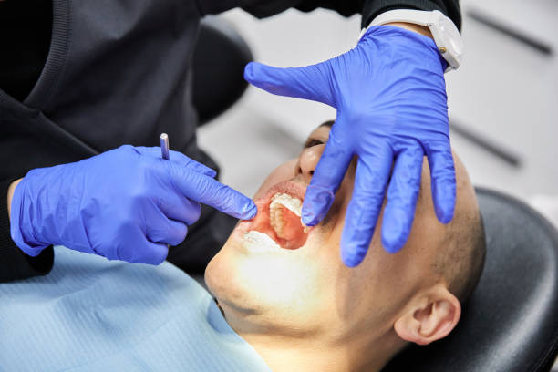 Best Emergency Dental Care for Broken or Chipped Teeth in Sangaree, SC
